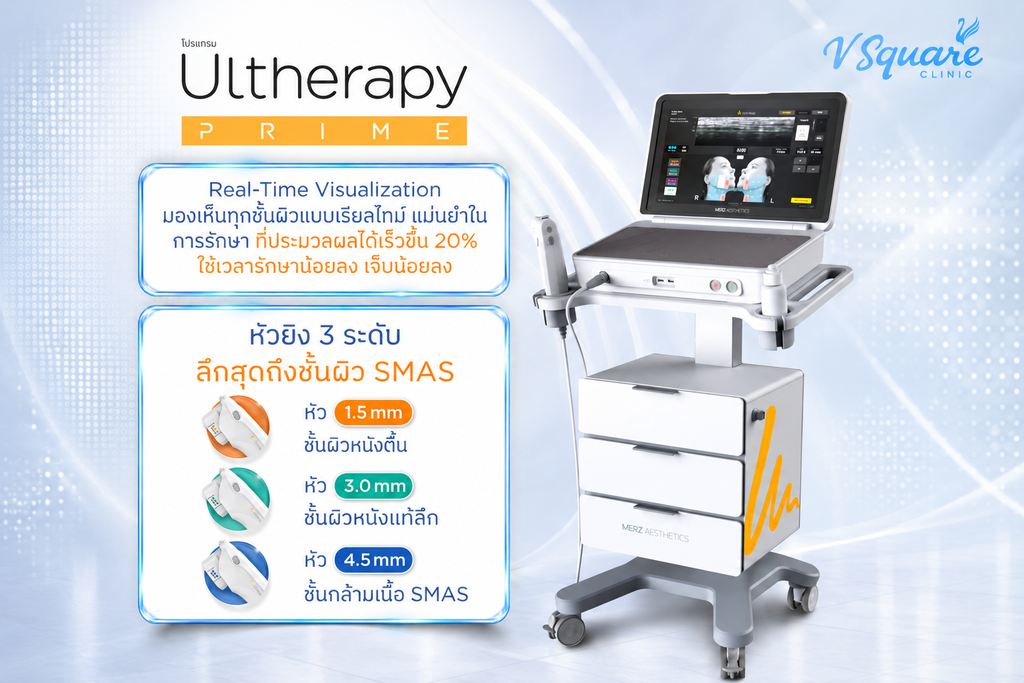 จุดเด่น Ulthera Prime
