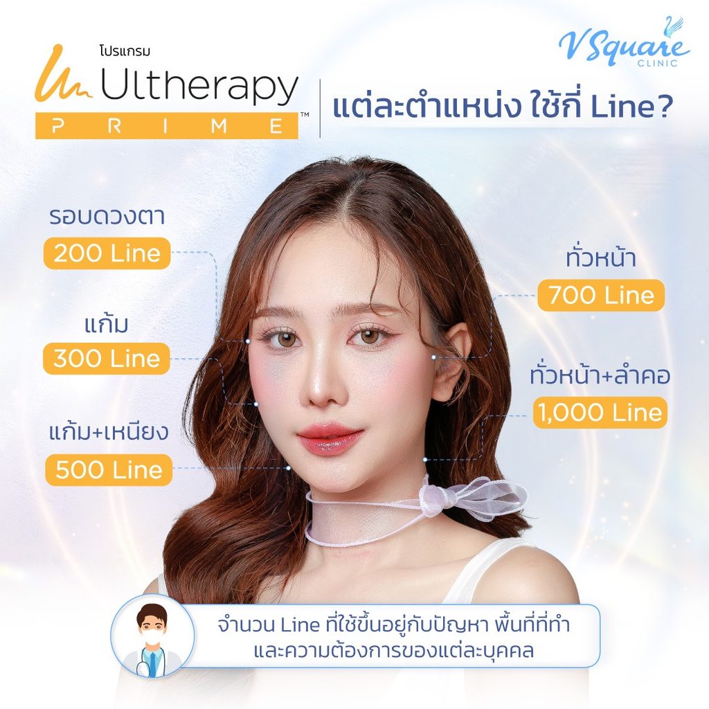 Ulthera Prime แต่ละตำแหน่งใช้กี่ไลน์