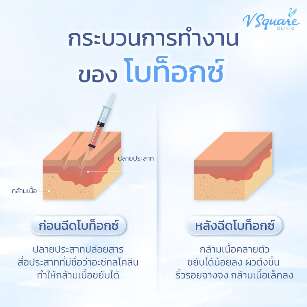 การทำงานของโบท็อก