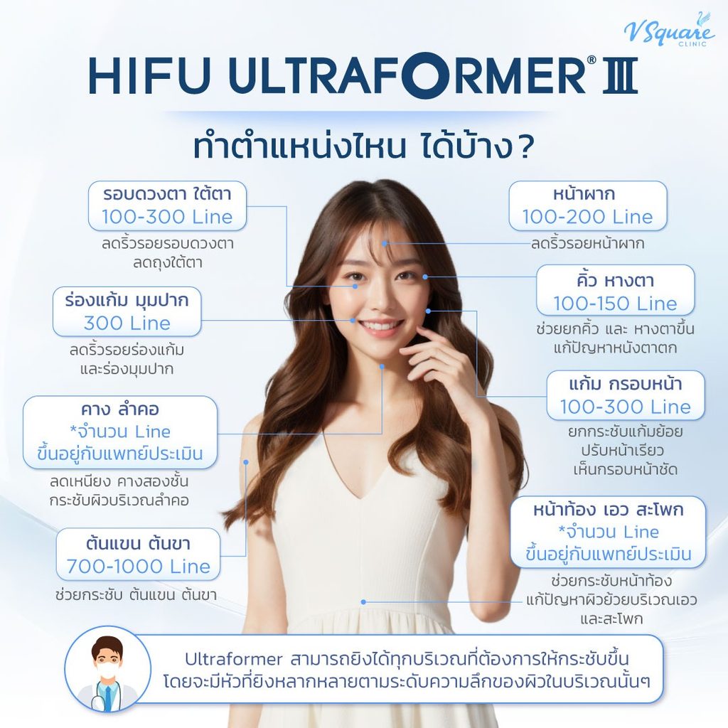 ตำแหน่งทำ Ultraformer III