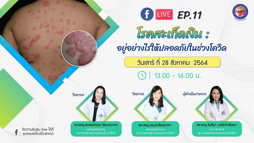 สมาคมแพทย์ผิวหนังฯ เชิญรับชมเพจเฟซบุ๊ก