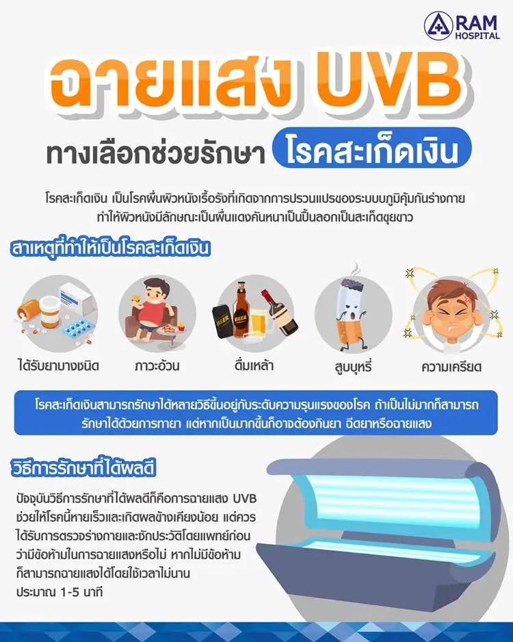 ฉายแสง UVB ทางเลือกช่วยรักษา