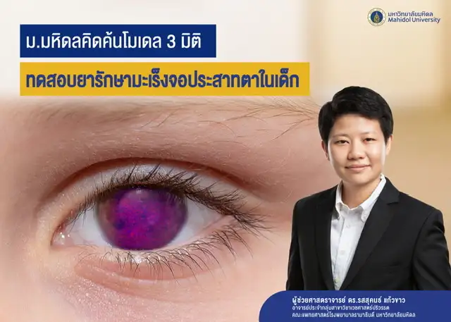 ม.มหิดลคิดค้นโมเดล 3 มิติ ทดสอบยารักษามะเร็งจอประสาทตาในเด็ก