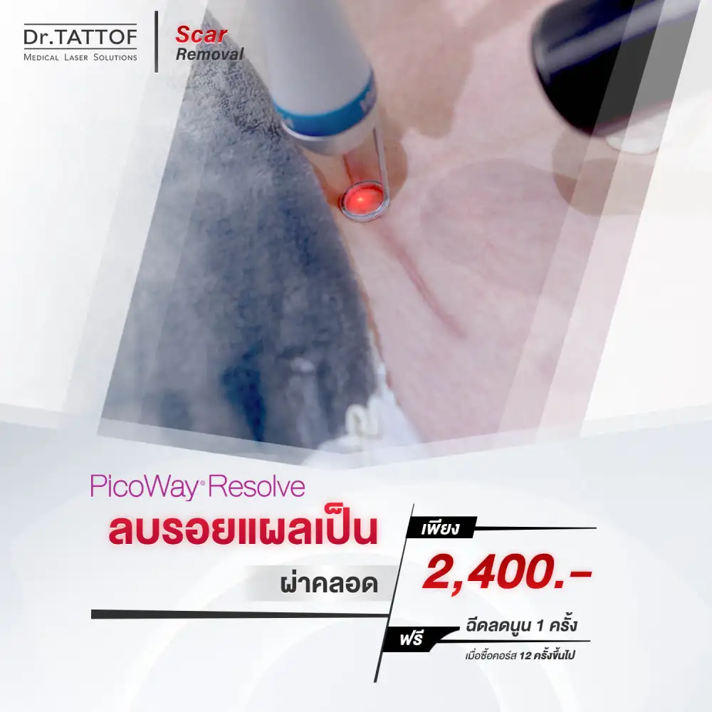 Dr.TATTOF Clinic จัดแคมเปญ