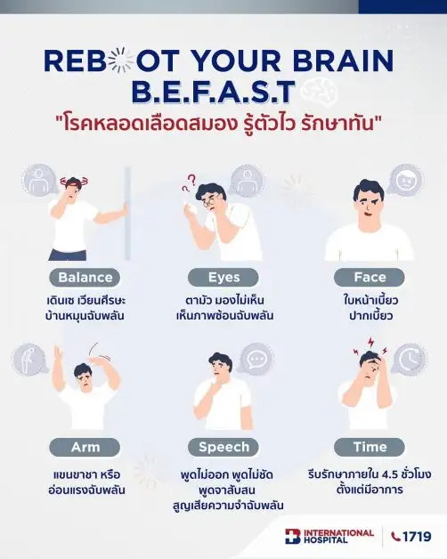สังเกตอาการเตือนโรคหลอดเลือดสมอง ตามหลักการ BEFAST รู้ไว ปลอดภัยจากโรคหลอดเลือดสมอง