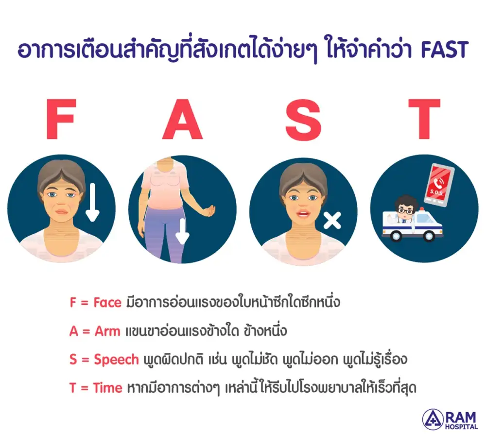 FAST โรคหลอดเลือดสมองสังเกตได้...ด้วยตัวคุณเอง