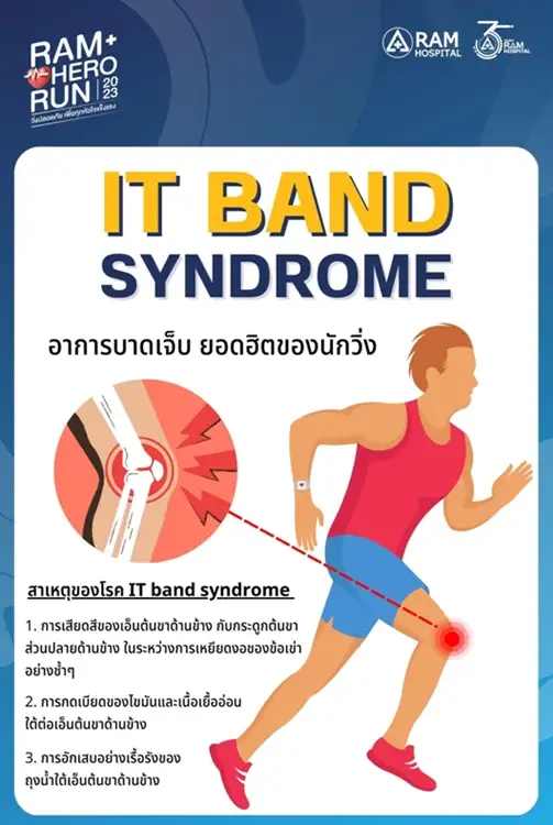 IT BAND SYNDROME อาการบาดเจ็บ ยอดฮิตของนักวิ่ง