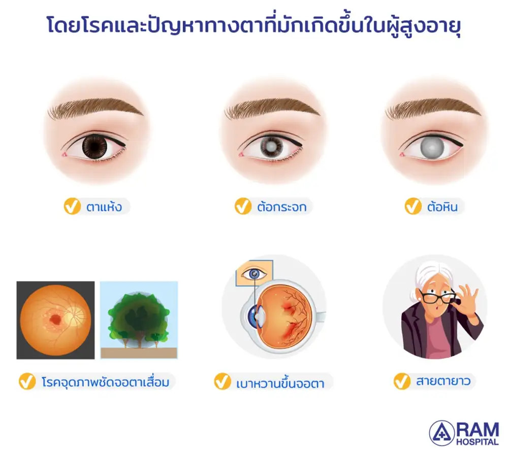 โรคตา.. ปัญหาที่พบบ่อยในผู้สูงอายุที่ต้องเตรียมรับมือ