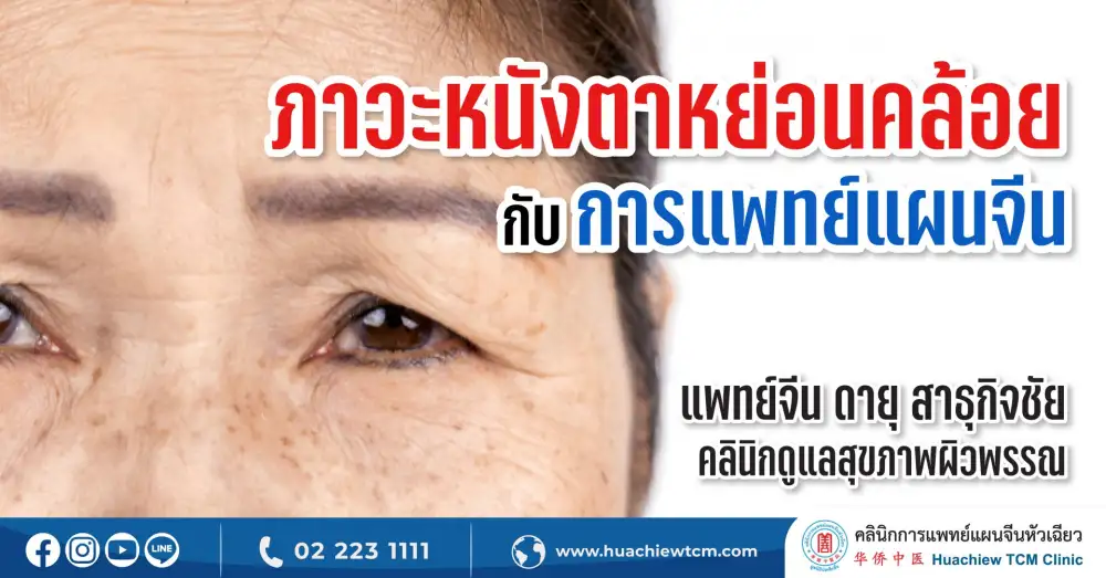 ภาวะหนังตาหย่อนคล้อย กับมุมมองในศาสตร์การแพทย์แผนจีน โดย คลินิกการแพทย์แผนจีนหัวเฉียว