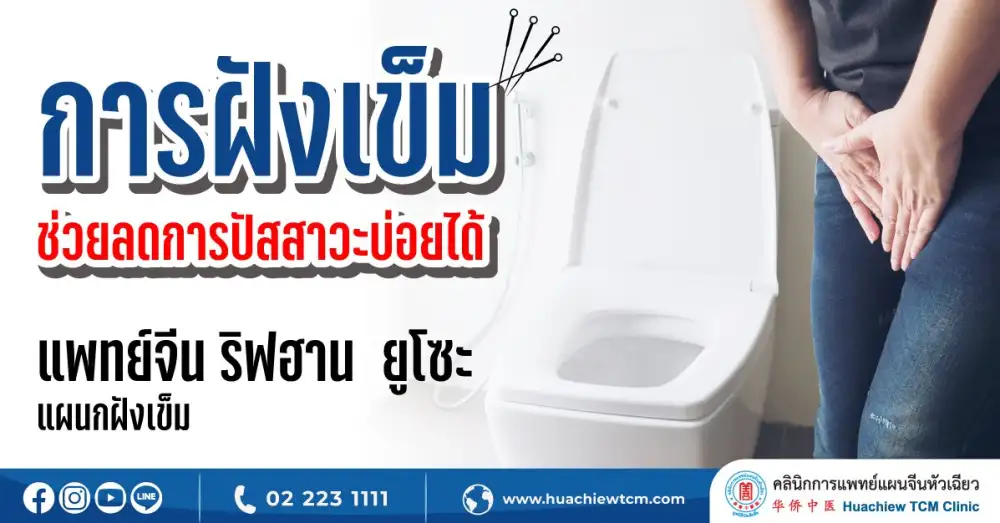 ปัสสาวะบ่อย รักษาได้ด้วยการฝังเข็ม โดย คลินิกการแพทย์แผนจีนหัวเฉียว