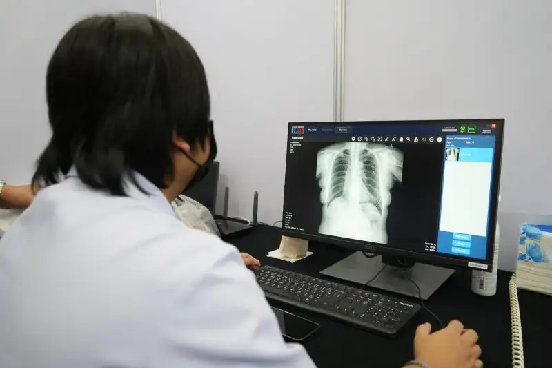 MDES - depa Launches AI for Better Life Project to Provide Free AI-Powered Preliminary Lung Cancer Screening Services for Thai People