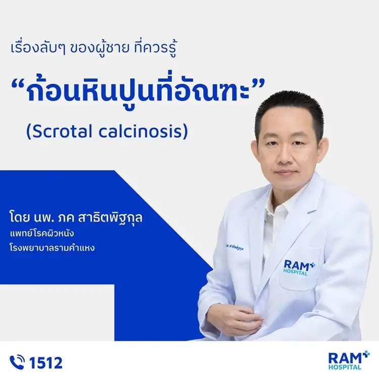 เรื่องลับๆ ของผู้ชาย ที่ควรรู้ : ก้อนหินปูนที่อัณฑะ