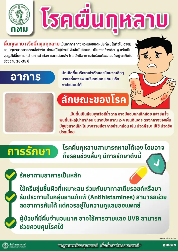 กทม. รุกเข้มเฝ้าระวังโรคผื่นกุหลาบ แนะวิธีป้องกันตนเอง ลดความเสี่ยงแพร่ระบาด