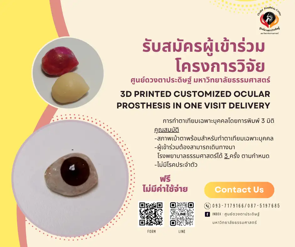 เชิญเข้าร่วมโครงการวิจัยตาเทียมเฉพาะบุคคลฟรี