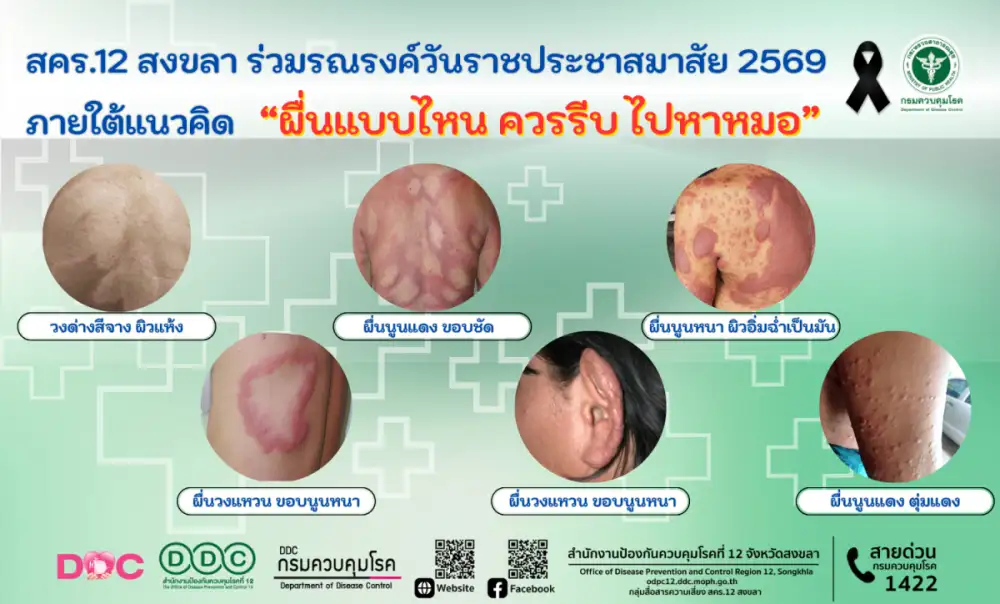 สคร.12 สงขลา ร่วมรณรงค์วันราชประชาสมาสัย 2569 ภายใต้แนวคิด