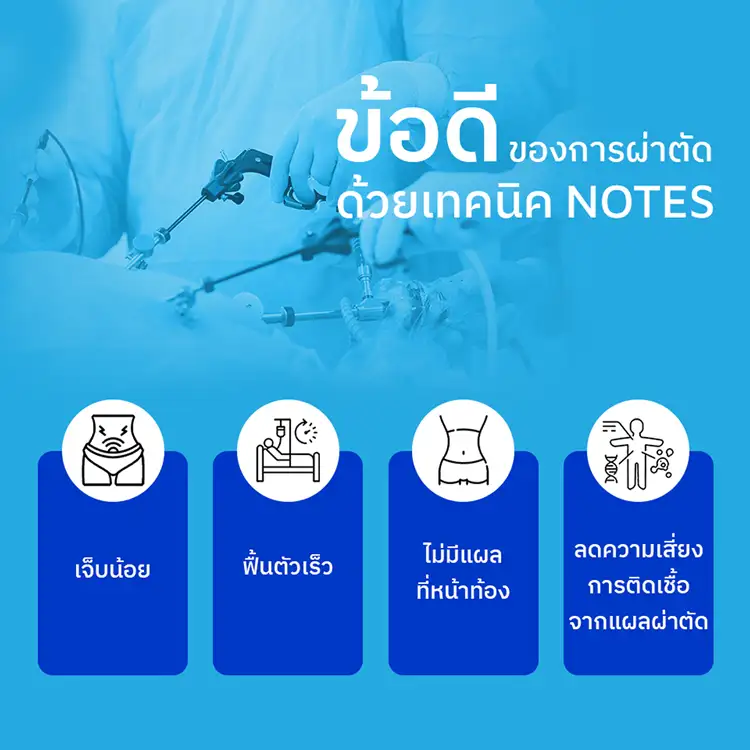 ผ่าตัดมดลูกไร้แผล ด้วยเทคนิค NOTES นวัตกรรมการผ่าตัดส่องกล้องยุคใหม่ ฟื้นตัวไว เจ็บน้อย