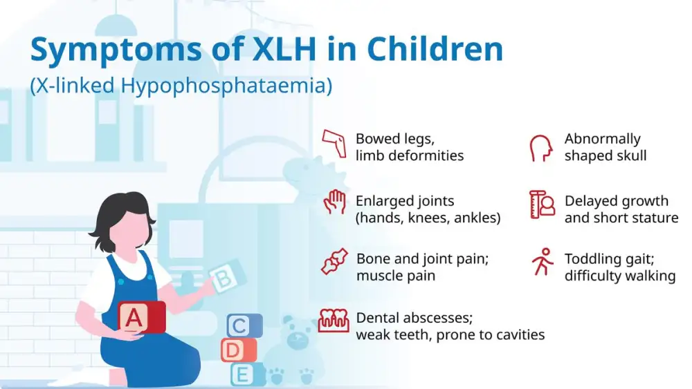 Thai Society for Pediatric Endocrinology and DKSH Raise Awareness of Rare Genetic Bone Disorder XLH