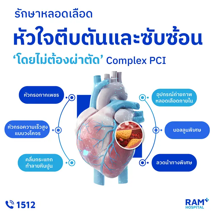 รักษาหลอดเลือดหัวใจตีบตันและซับซ้อน 'โดยไม่ต้องผ่าตัด' (Complex PCI)