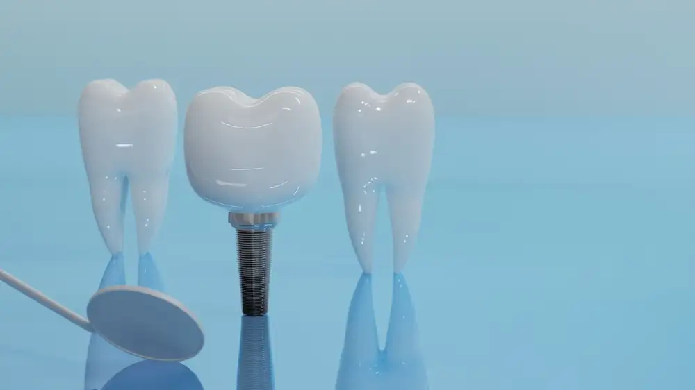 ทำรากฟันเทียมที่ไหนดี? วิธีเลือกคลินิกให้ปลอดภัยและได้ผลลัพธ์ดีที่สุด