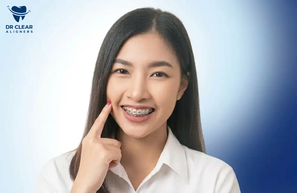 วัยทำงานสามารถจัดฟันได้ไหม ตอบชัดสำหรับคนวัย 30+