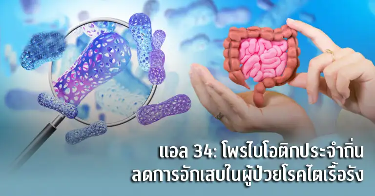 แพทย์จุฬาฯ พบโพรไบโอติกสายพันธุ์ท้องถิ่น ช่วยดักจับสารพิษ-ลดอักเสบในผู้ป่วยโรคไต