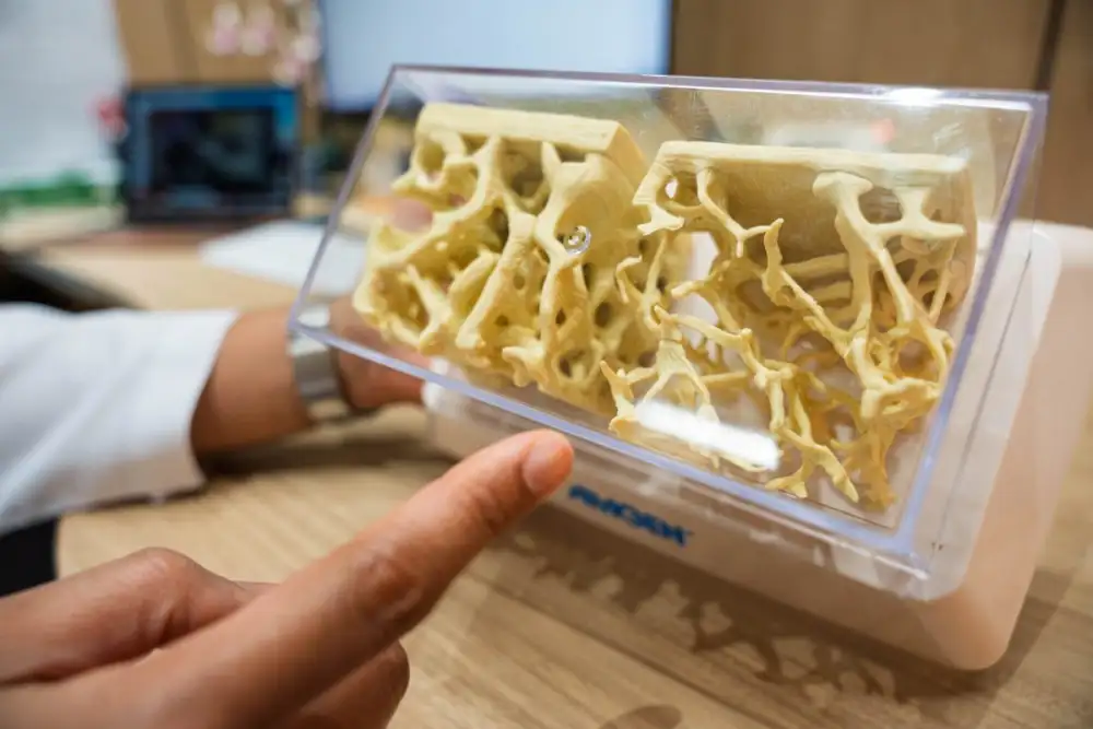 แค่ล้มเบา ๆ ก็เสี่ยงหัก รู้ทัน 'กระดูกพรุน' ภัยเงียบของผู้สูงอายุ