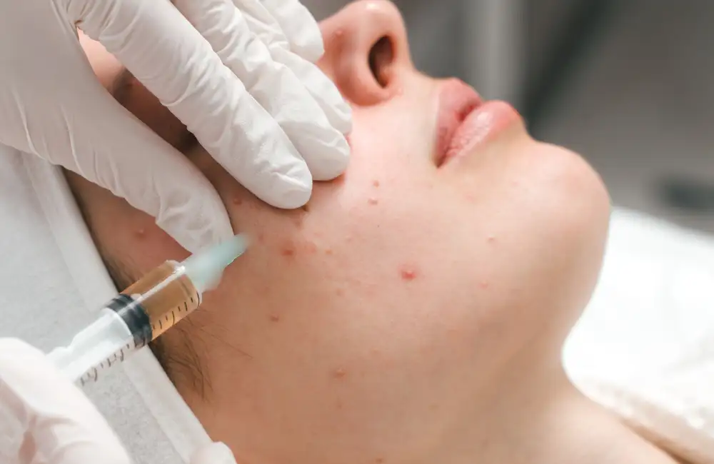 คอร์สรักษาสิว M Vita Clinic โปรแกรมดูแลผิวแบบ Customize เพื่อกระจ่างใส ไร้สิว