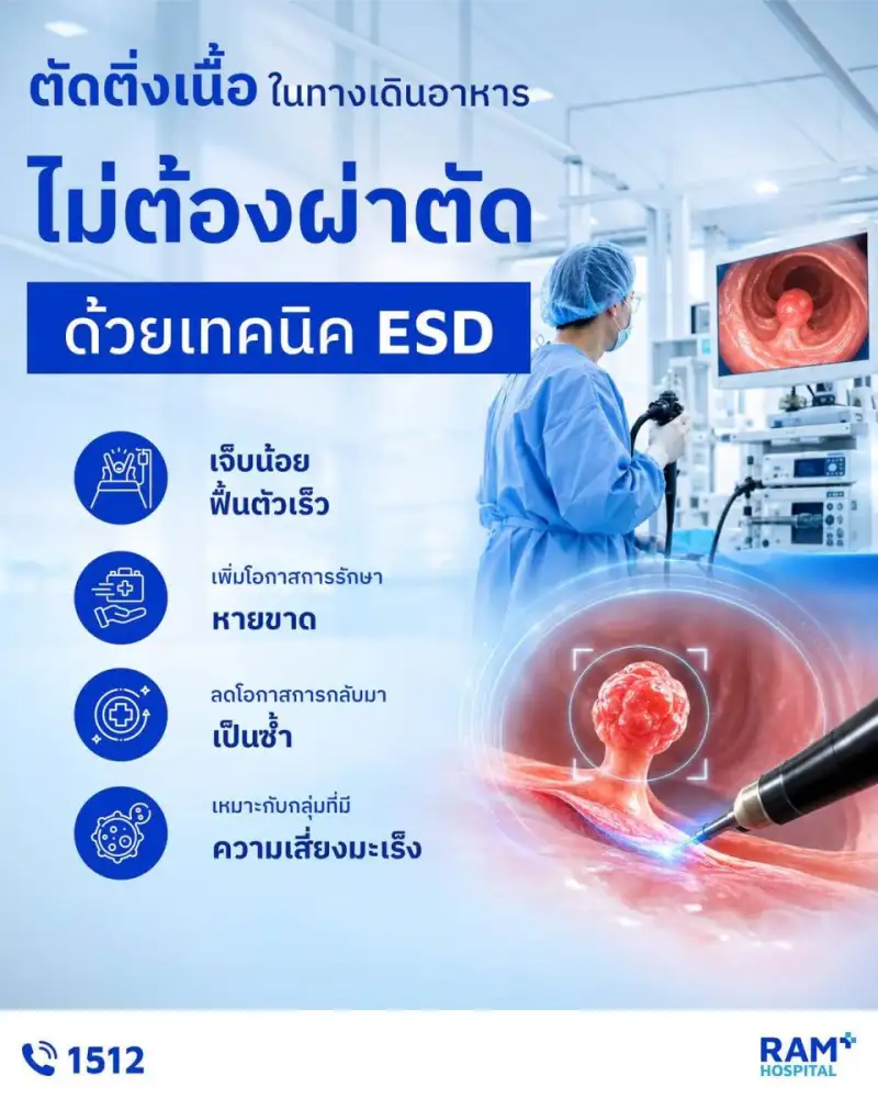 ตัดติ่งเนื้อในทางเดินอาหาร โดยไม่ต้องผ่าตัด ด้วยเทคนิค ESD