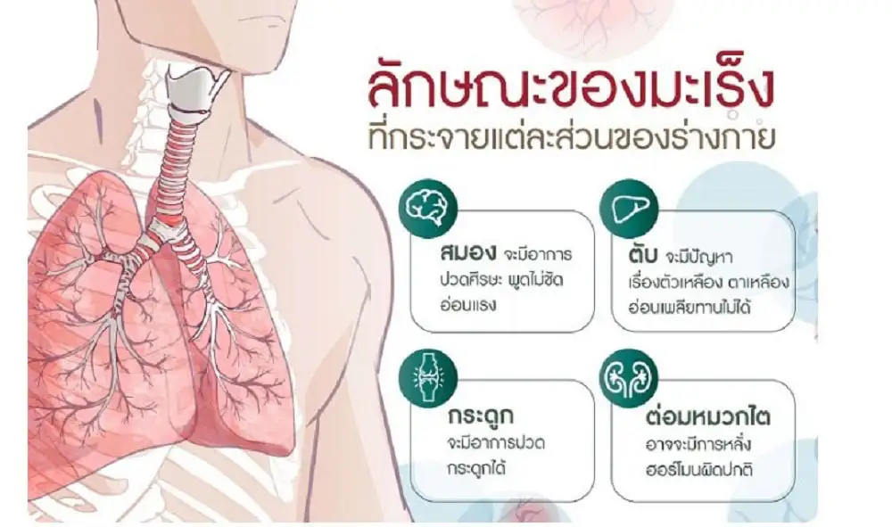 เมื่อมะเร็งกระจายมาที่ปอด การผ่าตัดยังเป็นความหวังของผู้ป่วยบางราย