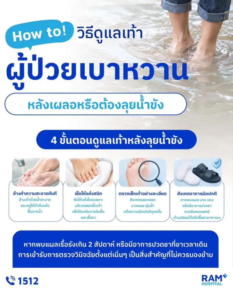 How to! วิธีดูแลเท้าผู้ป่วยเบาหวาน หลังเผลอหรือต้องลุยน้ำท่วม