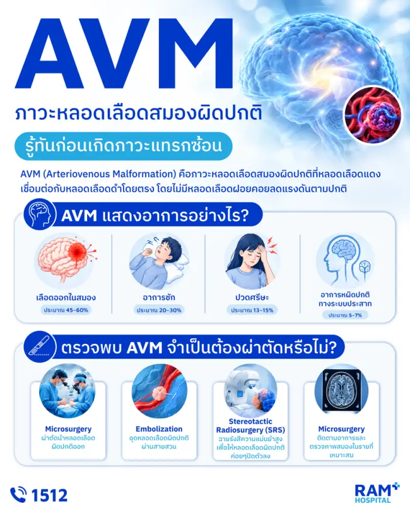 AVM หลอดเลือดสมองผิดปกติ รู้ทันก่อนเกิดภาวะแทรกซ้อน